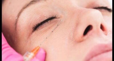 Praca kaniulą i igłą w okolicy oka - mezoterapia i stymulacja